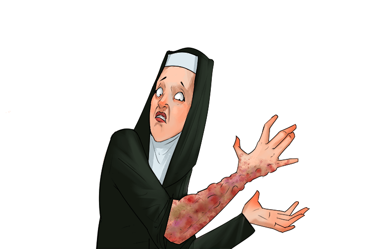 The ulcers on the nun (ulna) covered her arm from her elbow to her little finger
